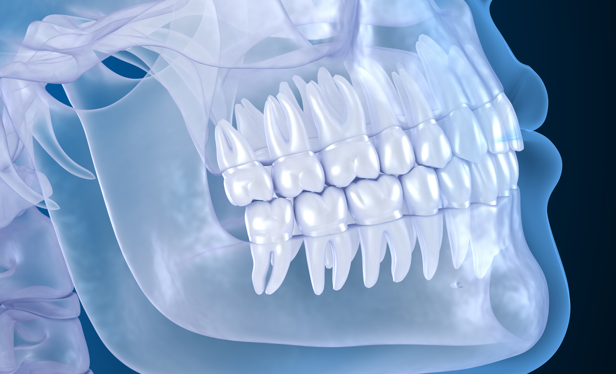 3D CBCT Scan